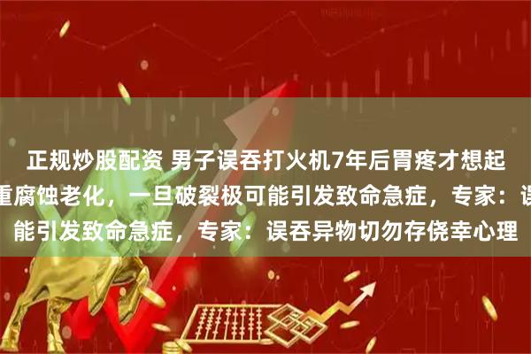 正规炒股配资 男子误吞打火机7年后胃疼才想起，胃镜显示外壳已被严重腐蚀老化，一旦破裂极可能引发致命急症，专家：误吞异物切勿存侥幸心理