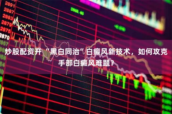 炒股配资开 “黑白同治”白癜风新技术，如何攻克手部白癜风难题？